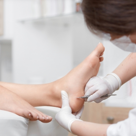Trattamento Piede Callus Peel