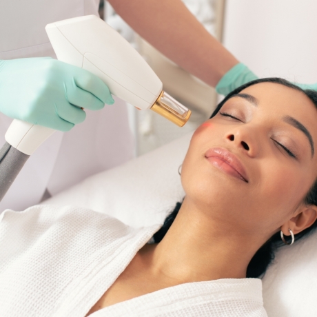 Epilazione Laser Contorno Viso