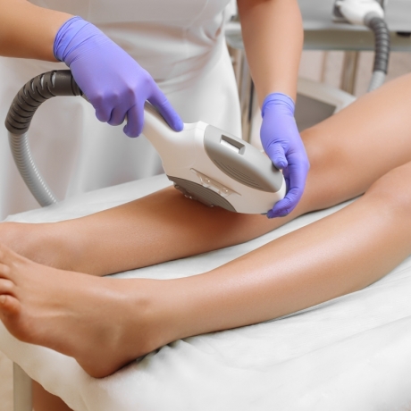 Epilazione Laser Gambaletto