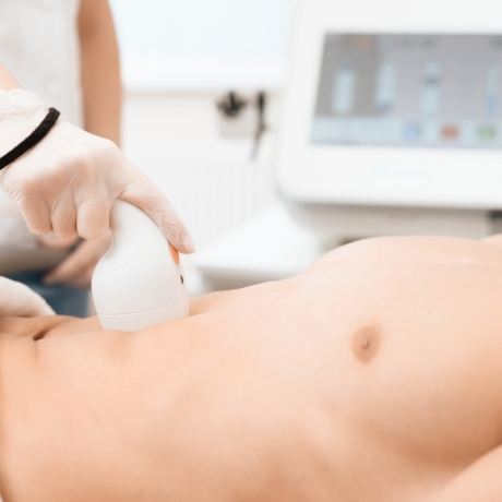 Epilazione Laser Addome