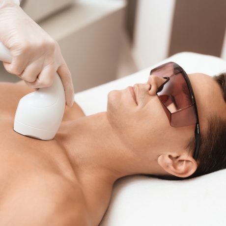 Epilazione Laser Petto