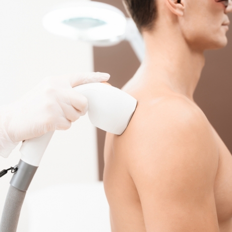 Epilazione Laser Schiena