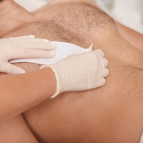 Epilazione Petto con Cera Tradizionale