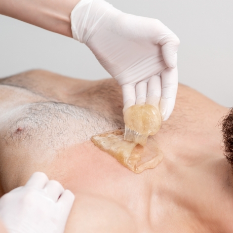 Epilazione Petto con Sugaring Wax