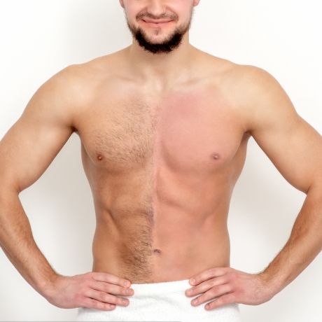 Epilazione Total Body con Cera Tradizionale